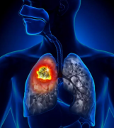 ��������ͬ����Ҫע��ΰ�����֢״