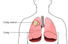 �ΰ����߼���������ǳ����ķΰ������ܻ��ã�