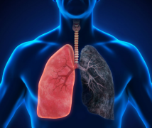 �ճ��Ӵ��ΰ����߻ᵼ�·ΰ���Ⱦ��