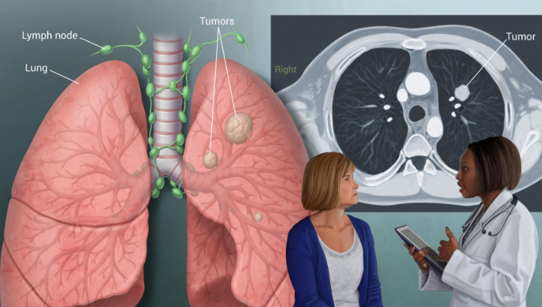 �ΰ��ᴫȾ��