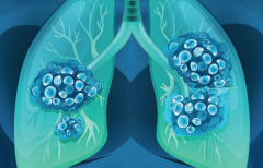 ��Ѫ����Ϊ�����ķΰ�������֢״