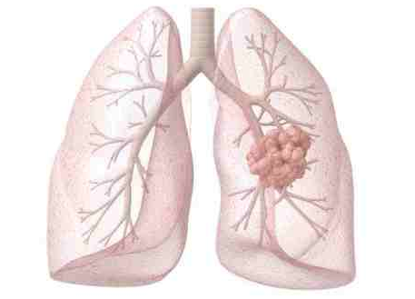 �ΰ���ת��