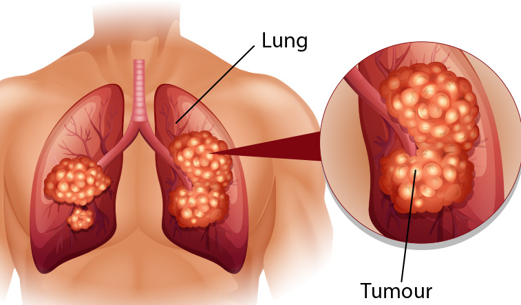 ��Сϸ���ΰ�