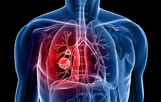 �ΰ�����