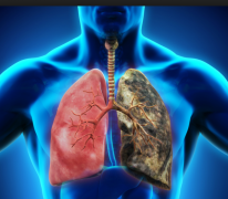 ���˷ΰ���Ѫ�⻹����Щ�����ķΰ�֢״