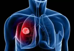 ����˻���ǽ�Ϊ�ձ鷢���ķΰ�����֢״