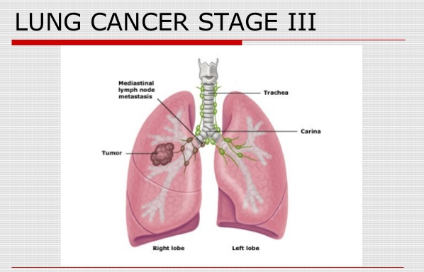 �ΰ����ڵ�֢״