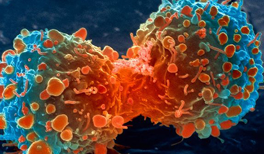 ��֢�ᴫȾ��