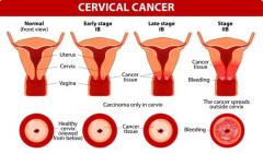 Ů�����ڹ�����֢״����Щ