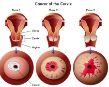 ��ͷ��Һ����Ϊ�������������ٰ�֢״