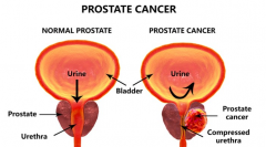 �˽�����ǰ���ٰ�֢״������������Ԥ��