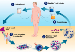 CAR-T�Ʒ��Ȱ�֢�����Ʒ�������Ϊ��֢���Ƶı�׼�Ʒ�