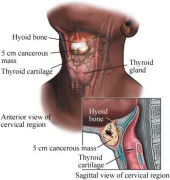 ���ڼ�״�ٰ�֢״�Ƚ����䲻�ױ�����