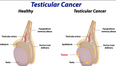 �ڳ��ڷ��ֵ���غ�谩֢״����Щ