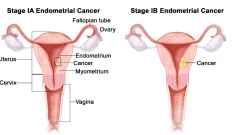 �����ӹ���֢״��Ҫ�����������������