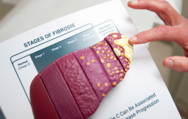 ���δ�Ⱦ��