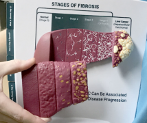 ����ѪҺ������������;���ᵼ�±��δ�Ⱦ��