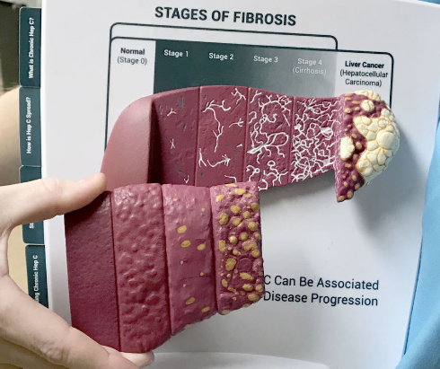 ���δ�Ⱦ��