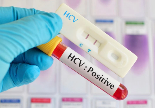 ������ʲô��