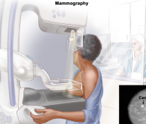 ��鰩ָ֢���������Щ����