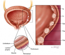 �о����ִ�������װ�֢״��Ѫ��