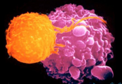 �»�����������з���һ��CAR-T�Ʒ�