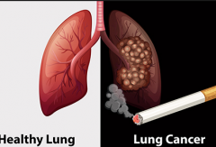 ���ڷΰ���ת�ƻ��߻���ָ�����ʹ��֢״