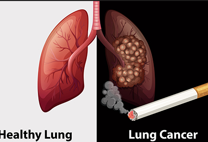�ΰ���ת��