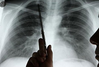 �ΰ���ת��