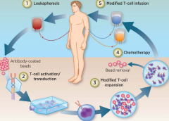 CAR-Tϸ���Ʒ���һ�ָ߶ȸ��Ի��İ�֢���Ʒ���