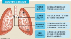 �ΰ������ڻ���ͻȻʧ�����ڷΰ�����֢״