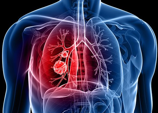 �ΰ�������