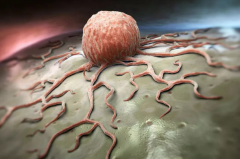 �м����Եİ�֢���Ŵ���