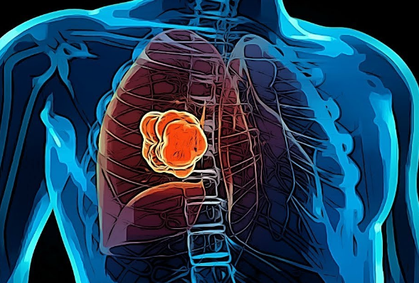 �ΰ�������ʲô֢״