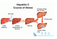 �������Ʊ��ε�ҽԺר�ҽ������Ʊ��εķ���