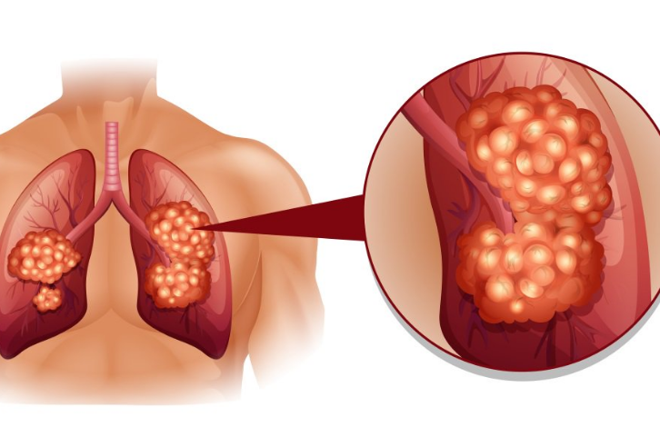 �ΰ����ڻ��ܻ���