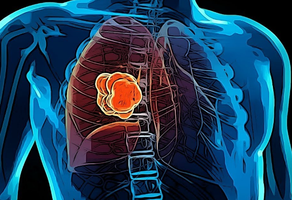 �ΰ�������ô����