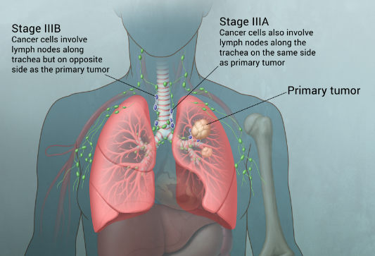 �ΰ�������ʲô֢״