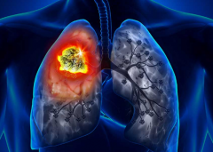 ���õķΰ���ת�Ƶ����Ʒ�������Щ