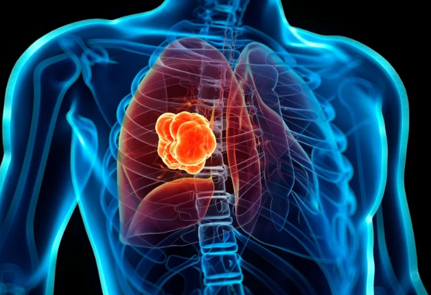 �ΰ���ת�Ƶ�����