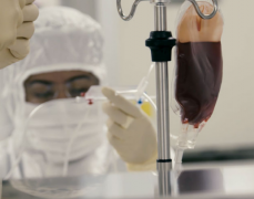 Yescarta��ȫ���׸�����DLBCL��CAR-T�Ʒ�