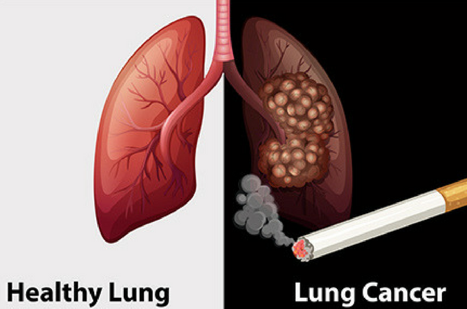 �ΰ�������֢״