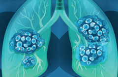 ��ʹ�ǻ��߾������ֳ����ķΰ�������֢״