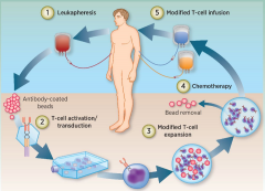 ���ڴ��ȵ����������Ʒ�CAR-Tϸ�����Ƶ�ԭ��