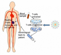 ��һ��ͨ����CAR-T����ϸ���Ʒ����ٰ�ȫ��ս