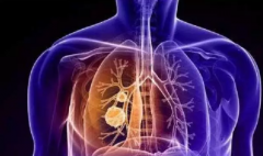 �ΰ��ᴫȾ��������������ר����ô˵��