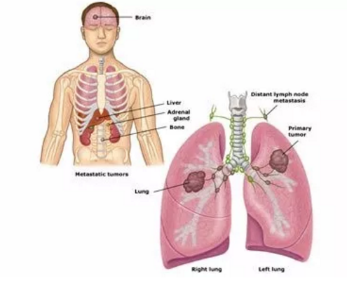 �ΰ���ת��֢״