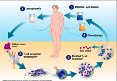 ŵ��CAR-T�Ʒ�����չ�������õ�����Ч��