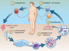 ŵ��CTL019���׸�������Ƕ�Ͽ�ԭ����Tϸ����CAR-T����Ʒ