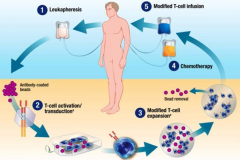 CAR-Tϸ�����Կ���Ұ���ͺ�CD19ͻ����Bϸ���ܰ���